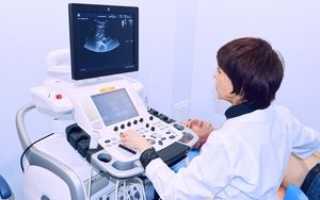 Что лучше УЗИ или МРТ брюшной полости: сравнение диагностических возможностей