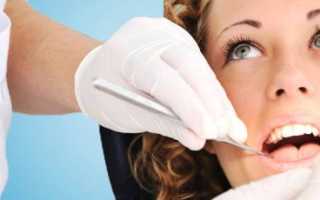 Двухэтапная имплантация – надежный метод восстановления зубов