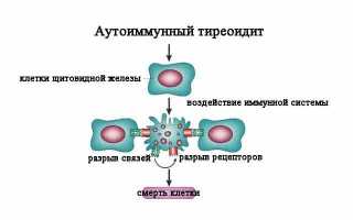 Как лечится аутоиммунный тиреоидит с гипотиреозом