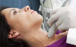 Симптомы и причины проблем со щитовидкой у женщин: как лечить