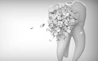 Имплантация эмали зубов — новейший подход к восстановлению без противопоказаний