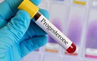 Прогестерон — как сдавать, нормы, причины отклонений