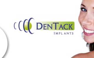 Решение проблемы дефицита кости с помощью расширяющихся имплантов Dentack