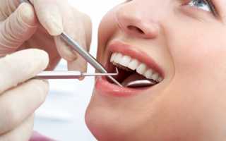 Что такое удлинение зубов и кому необходима процедура