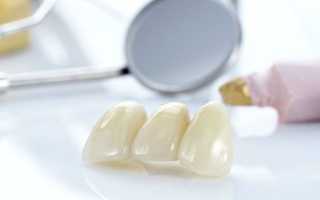 Назначение и характеристики стоматологической керамики