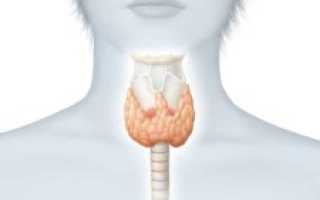 Гиперплазия щитовидной железы с диффузными изменениями