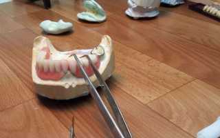 Как производится ремонт зубных протезов
