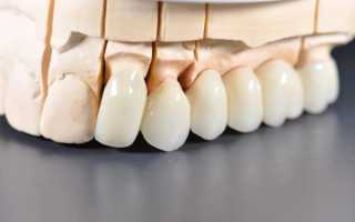 Секрет популярности безметалловых коронок на зубы