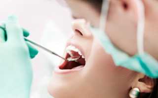 Гемисекция зуба – что это такое, и в каком случае назначается