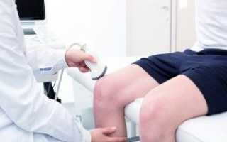 УЗИ коленного сустава: цена, где сделать в СПб и какую частную клинику лучше выбрать