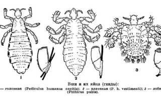 Через сколько дней вылупляются вши из гнид?