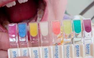 Цветные пломбы Twinky Star — лучшее решение для пломбирования молочных зубов