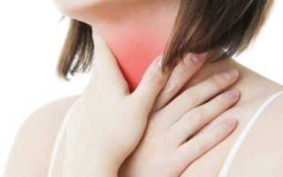 Альфа гемолитический стрептококк в горле