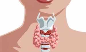 Диета при аутоиммунном тиреоидите щитовидной железы