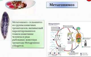 Что такое метагонимоз?