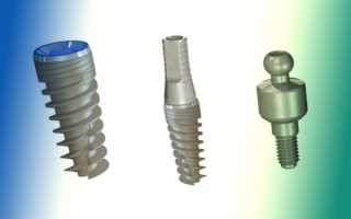 Четыре лучшие конструкции имплантатов Denti System