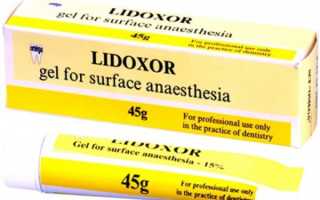 Лидоксор ― надежный партнер опытного стоматолога