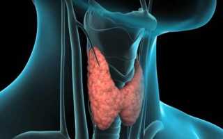 Анэхогенные образования щитовидной железы на УЗИ: причины, о чем говорят и что делать
