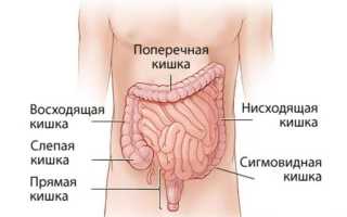 Что такое балантидиаз у человека?