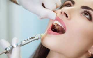 Инфильтрационная анестезия в стоматологии: что это и как проводится