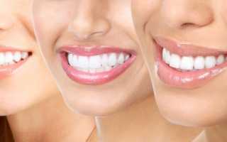 Отбеливание зубов с помощью перекиси водорода: методики и отзывы