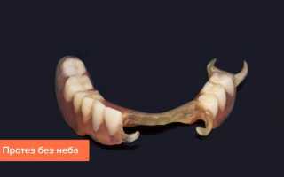 Зубные протезы без неба ― новаторская разработка в стоматологии