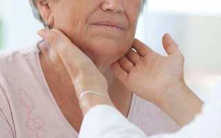 Симптомы рецидива рака щитовидной железы