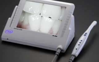 Уникальные возможности интраоральных камер в стоматологии нового поколения