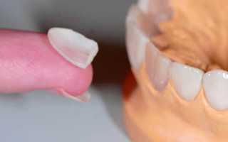 Насколько эффективна реставрация зубов с помощью ультраниров