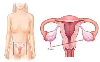 Размеры яичников в норме у женщин по УЗИ: таблица со значениями объема органа