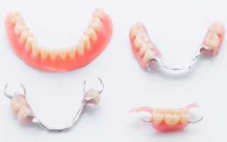 Зубные протезы: какие лучше и как правильно их выбрать?