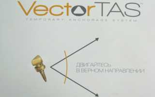 Микроимпланты Vector Tas – опора вашего успеха в коррекции аномалий прикуса