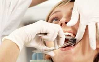 Цель использования турунды после удаления зуба