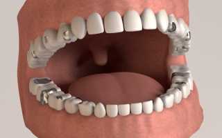 Отношение пациентов и специалистов к амальгаме в современной стоматологии