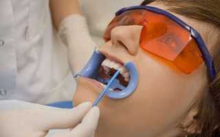 Десенситайзеры в стоматологии – результативное устранение гиперчувствительности зубов