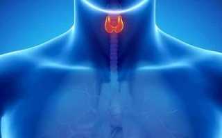 Что нужно знать о диффузном зобе щитовидной железы