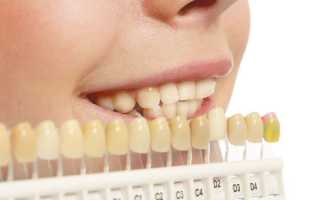 Тонкости специфицирования цвета зубов по Шкале Вита для восстановления эстетики улыбки