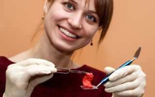 Области применения мембраны APRF в стоматологии и технология ее изготовления