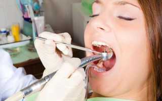 Что такое трепанация зуба, в каких случаях проводится эта процедура?
