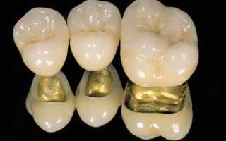 Применение шовных искусственных коронок в ортопедической стоматологии