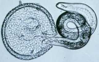 Лечение Вермоксом при токсокарозе