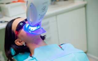 Отбеливание зубов «Зум 3» (Zoom 3): описание процедуры и отзывы о ней