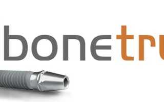 Чем отличаются зубные импланты BoneTrust от систем других брендов?