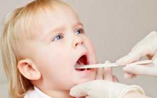 Лечение стрептококка в носу у ребенка