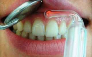 Насколько востребована вакуум-терапия в стоматологии и суть методики
