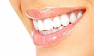 Чем можно без вреда отбелить зубы в домашних условиях?