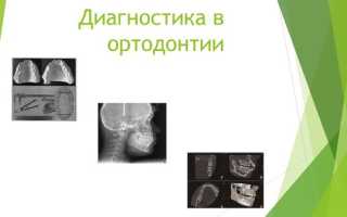 Обязательные и второстепенные способы диагностики в ортодонтии
