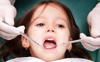 Как и зачем проводится серебрение молочных зубов?
