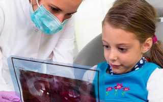 Когда ребенку нужен визит к ортодонту