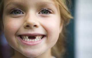 Чего нужно ожидать после выпадения молочных зубов